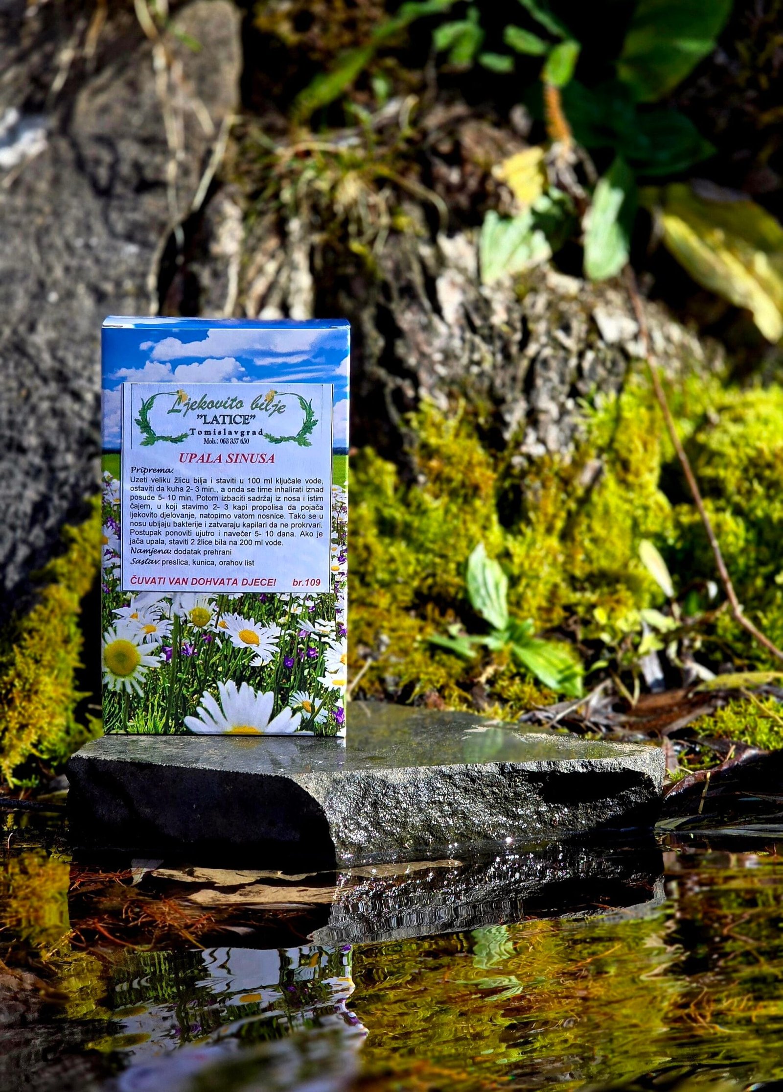 upala sinusa Upala sinusa - Slika 1