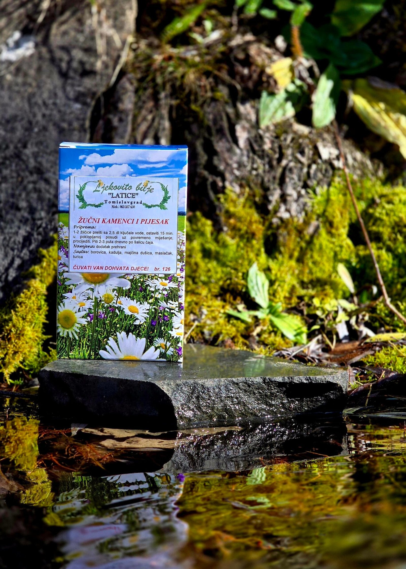 zucni kamenac i pijesak Žučni kamenci i pijesak - Slika 1